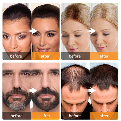 GarageLine®🎁Hairline Powder - RInstant Root Cover & Fill