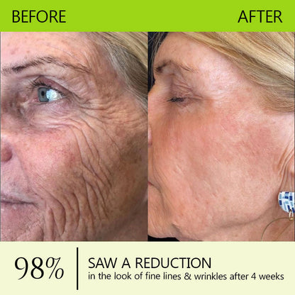 Hudros® Botox & Vita-A Retinol Shot Wrinkle-Lift Tightening cream - Last Day Promotion 70% OFF