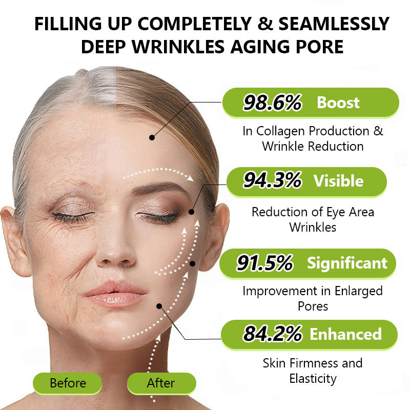 Hudros® Botox & Vita-A Retinol Shot Wrinkle-Lift Tightening cream - Last Day Promotion 70% OFF