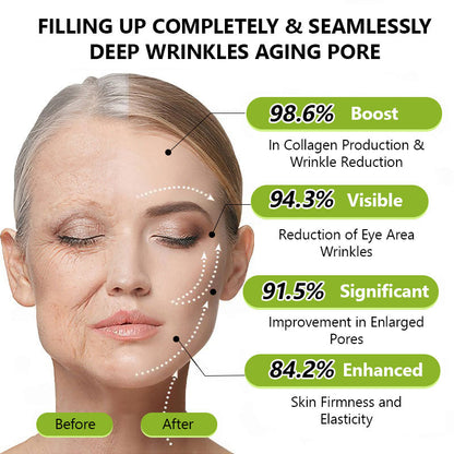 Hudros® Botox & Vita-A Retinol Shot Wrinkle-Lift Tightening cream - Last Day Promotion 70% OFF