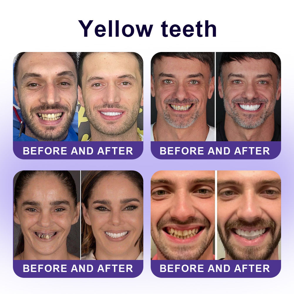 Official Store |🦷GarageLine® Nano-Hydroxyapatite Purple Whitening Strips - Professional Enamel Care & Brightening