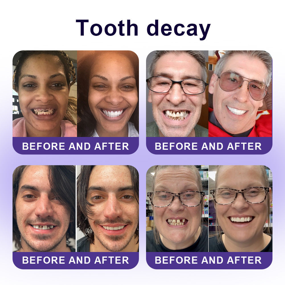 Official Store |🦷GarageLine® Nano-Hydroxyapatite Purple Whitening Strips - Professional Enamel Care & Brightening