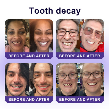 Official Store |🦷GarageLine® Nano-Hydroxyapatite Purple Whitening Strips - Professional Enamel Care & Brightening