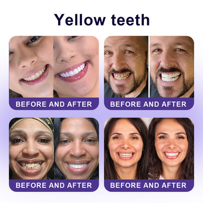 Official Store |🦷GarageLine® Nano-Hydroxyapatite Purple Whitening Strips - Professional Enamel Care & Brightening
