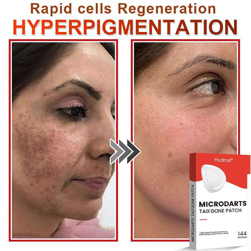 70%📌Hudros® 2-in-1 Microneedle & Hydrocolloid Patch | Raised Moles,Acne,  Flat Warts & Skin Tags Remover | Improves Wrinkles, Scars & Blemishes | Invisible Star Pimple Patches for Face & Body | 144 Count（xy）