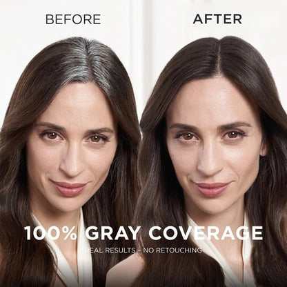 GarageLine®🎁Hairline Powder - RInstant Root Cover & Fill