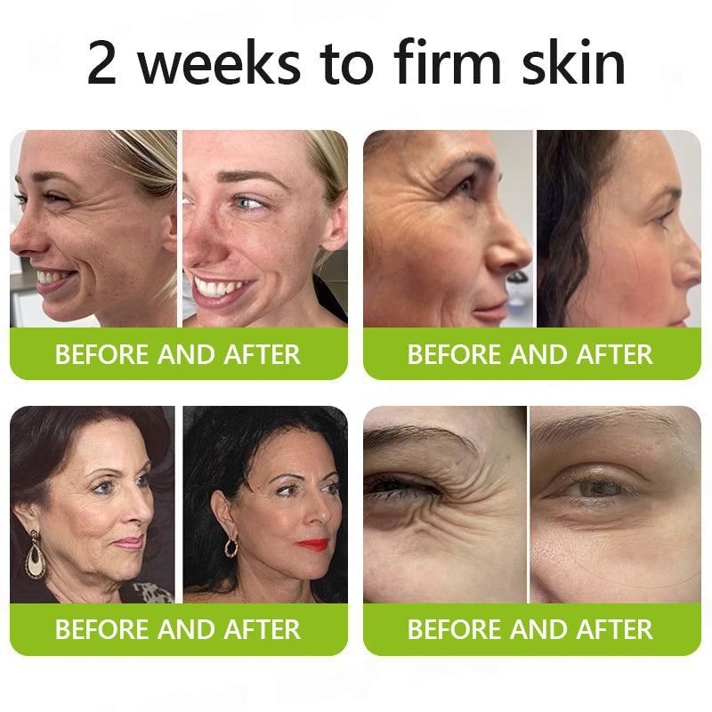 Hudros® Botox & Vita-A Retinol Shot Wrinkle-Lift Tightening cream - Last Day Promotion 70% OFF