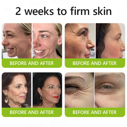 Hudros® Botox & Vita-A Retinol Shot Wrinkle-Lift Tightening cream - Last Day Promotion 70% OFF