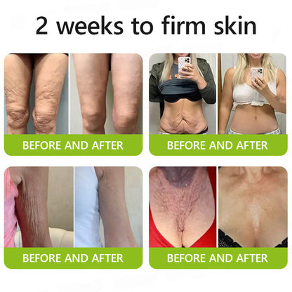 Hudros® Botox & Vita-A Retinol Shot Wrinkle-Lift Tightening cream - Last Day Promotion 70% OFF