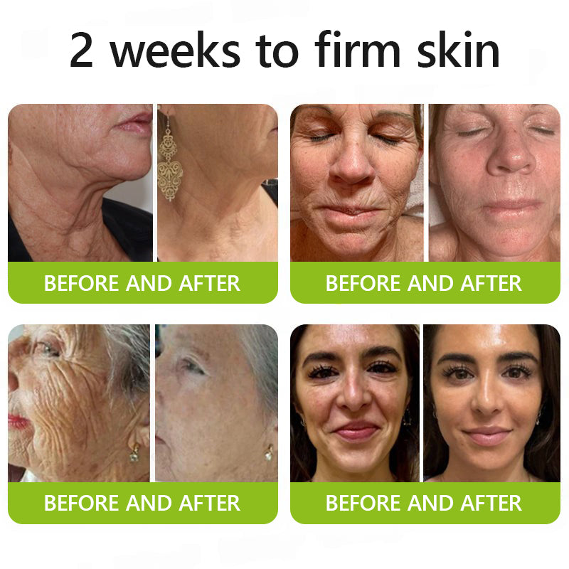 Hudros® Botox & Vita-A Retinol Shot Wrinkle-Lift Tightening cream - Last Day Promotion 70% OFF
