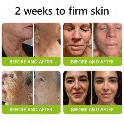 Hudros® Botox & Vita-A Retinol Shot Wrinkle-Lift Tightening cream - Last Day Promotion 70% OFF