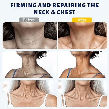✨ Instant Neck Lift Cream  — 🧴 Infused with Retinol & Hyaluronic Acid | Firms the Neck, Reduces Wrinkles & Double Chin