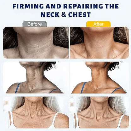 ✨ Instant Neck Lift Cream  — 🧴 Infused with Retinol & Hyaluronic Acid | Firms the Neck, Reduces Wrinkles & Double Chin